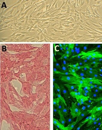 Human Aortic Smooth Muscle Cells (HAOSMC) Human Aortic Smooth Muscle Cells (HAOSMC)