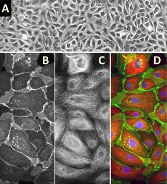 Human Mammary Epithelial Cells (HMEpC) Human Mammary Epithelial Cells (HMEpC)