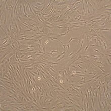 Human Fibroblast-Like Synoviocytes (HFLS)