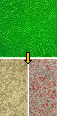 Human Preadipocytes (HPAd) Human Preadipocytes (HPAd)