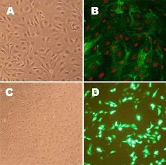 Human pulmonary artery endothelial cells Human Pulmonary Artery Endothelial Cells (HPAEC)