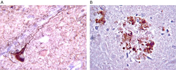 Anti-β-Amyloid antibody staining