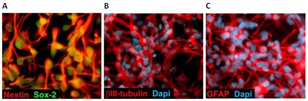 Differentiation of Neural Stem Cells.