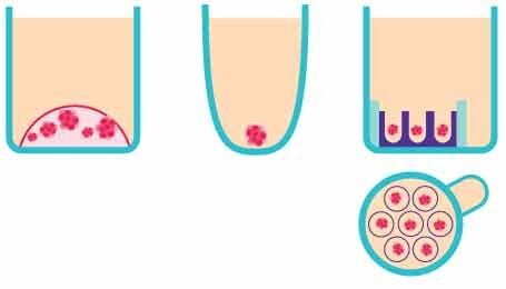 Schematic representation of the <i>in vitro</i> 3D organoid screening methods. From left to right, Matrigel<sup>®</sup>, a non-adherent surface, and Millicell<sup>®</sup> Microwell plates. : Schematic of three in vitro 3D organoid screening methods
