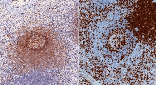 Immunohistochemical staining