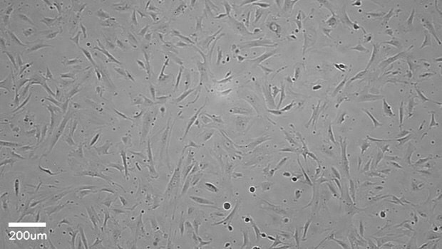 Stellate cells