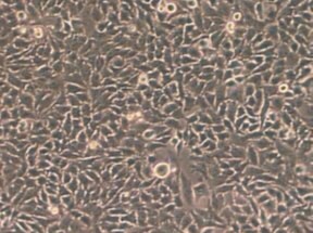 HeLa -epithelial HeLa -epithelial