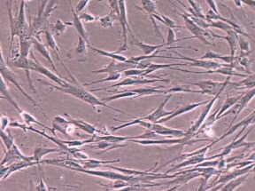 MRC-5 -fibroblast MRC-5 -fibroblast