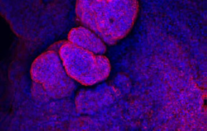 3D organoid cell culture 3D organoid cell culture