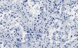 Anti-PI3 Kinase p110 β Antibody, clone 1D18 ZooMAb&#174; Rabbit Monoclonal recombinant, expressed in HEK 293 cells