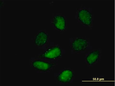 Anti-HDAC9 antibody produced in mouse purified immunoglobulin, buffered aqueous solution