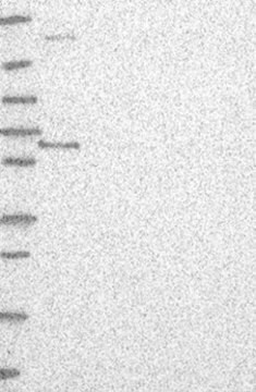 Anti-ETV3 antibody produced in rabbit Prestige Antibodies&#174; Powered by Atlas Antibodies, affinity isolated antibody, buffered aqueous glycerol solution