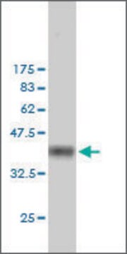 ANTI-FHIT antibody produced in mouse clone 1A2, ascites fluid