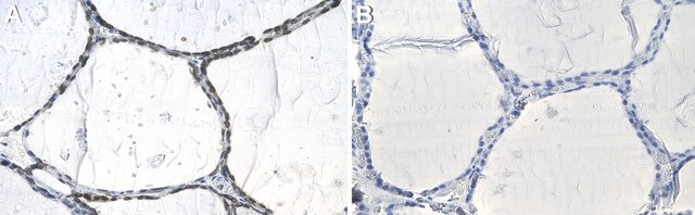 Anti-Emerin Antibody, clone 1C22 ZooMAb&#174; Rabbit Monoclonal recombinant, expressed in HEK 293 cells