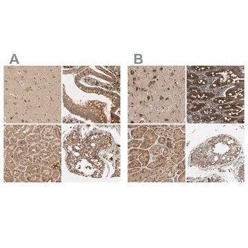 Anti-MRPS22 antibody produced in rabbit Prestige Antibodies&#174; Powered by Atlas Antibodies, affinity isolated antibody, buffered aqueous glycerol solution, Ab2