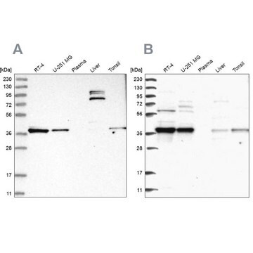 Anti-TBCC antibody produced in rabbit Prestige Antibodies&#174; Powered by Atlas Antibodies, affinity isolated antibody, buffered aqueous glycerol solution