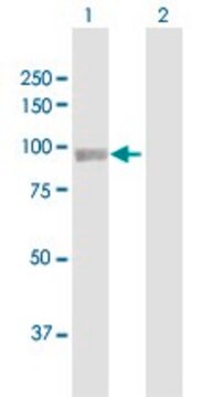 Anti-PYGL antibody produced in rabbit purified immunoglobulin, buffered aqueous solution