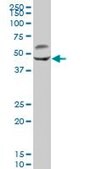 Anti-CAMK2G antibody produced in mouse IgG fraction of antiserum, buffered aqueous solution