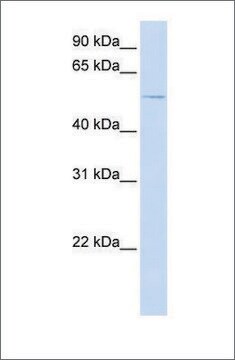 Anti-ACVR1 antibody produced in rabbit affinity isolated antibody