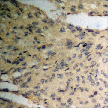 Anti-phospho-Pim-1 (pTyr309) antibody produced in rabbit affinity isolated antibody