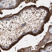 Anti-HSD17B1 antibody produced in rabbit Prestige Antibodies&#174; Powered by Atlas Antibodies, affinity isolated antibody, buffered aqueous glycerol solution