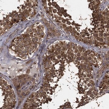 Anti-Mier2 Antibody Produced In Rabbit Prestige Antibodies&#174; Powered by Atlas Antibodies, affinity isolated antibody, buffered aqueous glycerol solution
