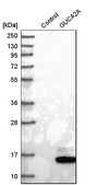 Anti-GUCA2A antibody produced in rabbit Prestige Antibodies&#174; Powered by Atlas Antibodies, affinity isolated antibody, buffered aqueous glycerol solution