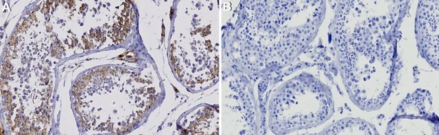 Anti-TMEM106B Antibody, clone 2E4 ZooMAb&#174; Rabbit Monoclonal recombinant, expressed in HEK 293 cells