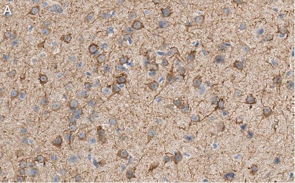 Anti-MAP2 Antibody, clone AP20 ZooMAb&#174; Mouse Monoclonal recombinant, expressed in HEK 293 cells