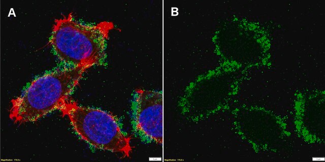 Anti-GSS Antibody, clone 1F4 ZooMAb&#174; Rabbit Monoclonal recombinant, expressed in HEK 293 cells