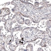Monoclonal Anti-LAMA2 antibody produced in mouse Prestige Antibodies&#174; Powered by Atlas Antibodies, clone CL3450, purified immunoglobulin, buffered aqueous glycerol solution