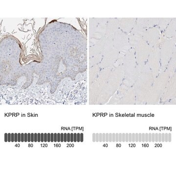 Anti-KPRP antibody produced in rabbit Prestige Antibodies&#174; Powered by Atlas Antibodies, affinity isolated antibody, buffered aqueous glycerol solution