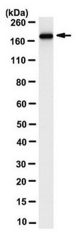 Anti-Myomesin-2 Antibody, clone 3B9.3 clone 3B9.3, from mouse