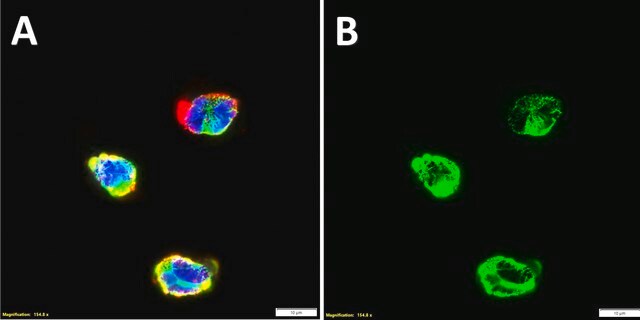 Anti-CD1a Antibody, clone 3J8 ZooMAb&#174; Rabbit Monoclonal recombinant, expressed in HEK 293 cells