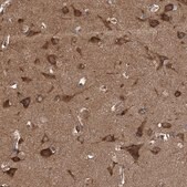 Anti-KCNJ2 antibody produced in rabbit Prestige Antibodies&#174; Powered by Atlas Antibodies, affinity isolated antibody, buffered aqueous glycerol solution