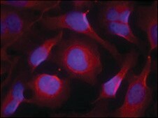 Anti-PTK2B (Ab-402) antibody produced in rabbit affinity isolated antibody