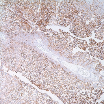 Thrombomodulin (1009) Mouse Monoclonal Antibody