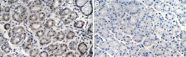 Anti-KLF2 Antibody, clone 1C3 ZooMAb&#174; Rabbit Monoclonal recombinant, expressed in HEK 293 cells