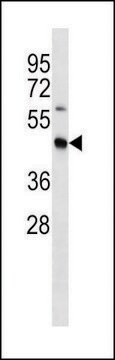 ANTI-MOUSE STRADB (C-TERM) antibody produced in rabbit IgG fraction of antiserum, buffered aqueous solution