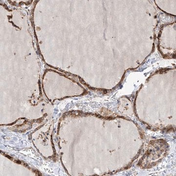 Anti-SLC43A3 antibody produced in rabbit Prestige Antibodies&#174; Powered by Atlas Antibodies, affinity isolated antibody, buffered aqueous glycerol solution