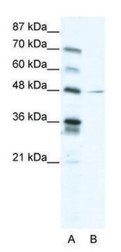 Anti-NFIC (C-terminal) antibody produced in rabbit affinity isolated antibody