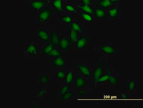 Anti-CCDC131 antibody produced in mouse purified immunoglobulin, buffered aqueous solution