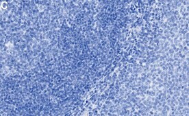 Anti-Fyn Antibody, clone 2F15 ZooMAb&#174; Rabbit Monoclonal recombinant, expressed in HEK 293 cells