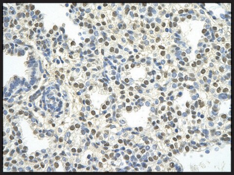 Anti-PATZ1 antibody produced in rabbit affinity isolated antibody