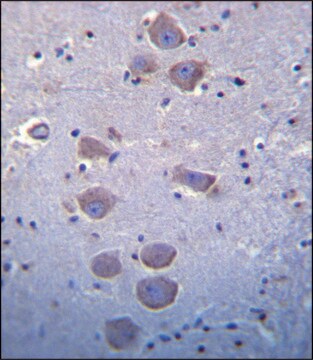 ANTI-MOUSE TLR8 (C-TERM) antibody produced in rabbit IgG fraction of antiserum, buffered aqueous solution