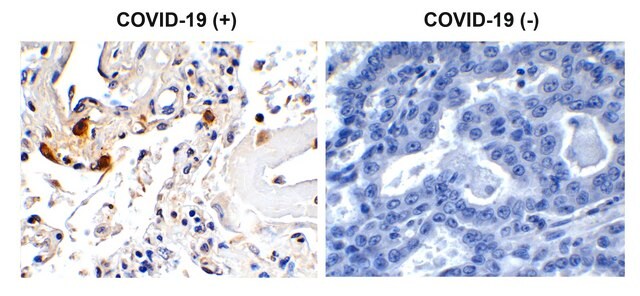 Anti-SARS-CoV-2 (COVID-19, 2019-nCoV) Envelope antibody produced in rabbit affinity isolated antibody