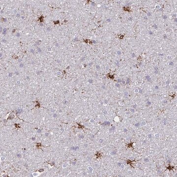 Anti-ASPH antibody produced in rabbit Prestige Antibodies&#174; Powered by Atlas Antibodies, affinity isolated antibody, buffered aqueous glycerol solution