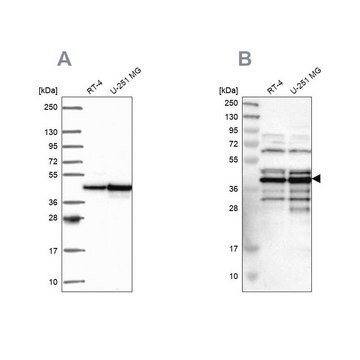 Anti-SLBP antibody produced in rabbit Prestige Antibodies&#174; Powered by Atlas Antibodies, affinity isolated antibody