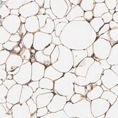 Anti-PRKAR2B antibody produced in rabbit Prestige Antibodies&#174; Powered by Atlas Antibodies, affinity isolated antibody, buffered aqueous glycerol solution
