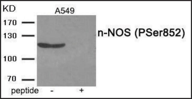 Anti-phospho-n-NOS (pSer852) antibody produced in rabbit affinity isolated antibody